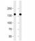 Fms Related Tyrosine Kinase 4 antibody, F52354-0.4ML, NSJ Bioreagents, Western Blot image 