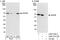 NOP56 Ribonucleoprotein antibody, A302-721A, Bethyl Labs, Western Blot image 