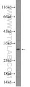 HIV-1 Tat Interactive Protein 2 antibody, 10251-1-AP, Proteintech Group, Western Blot image 