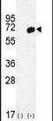 Haptoglobin antibody, PA5-24174, Invitrogen Antibodies, Western Blot image 
