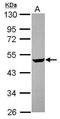 Carbohydrate Sulfotransferase 4 antibody, PA5-31522, Invitrogen Antibodies, Western Blot image 