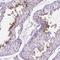 Transmembrane Protein 210 antibody, NBP2-49498, Novus Biologicals, Immunohistochemistry paraffin image 