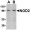 Nucleotide Binding Oligomerization Domain Containing 2 antibody, AP08944PU-N, Origene, Western Blot image 