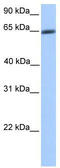 Zinc Finger Protein 449 antibody, TA331621, Origene, Western Blot image 