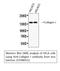 Collagen Type I Alpha 1 Chain antibody, STJ98915, St John