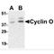 Cyclin O antibody, MBS150476, MyBioSource, Western Blot image 