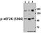 Eukaryotic Elongation Factor 2 Kinase antibody, A02277S366-1, Boster Biological Technology, Western Blot image 