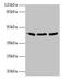 Isocitrate Dehydrogenase (NAD(+)) 3 Beta antibody, LS-B13001, Lifespan Biosciences, Western Blot image 