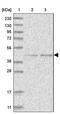 Glycosyltransferase Like Domain Containing 1 antibody, PA5-57774, Invitrogen Antibodies, Western Blot image 