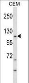 c-Kit antibody, LS-C160000, Lifespan Biosciences, Western Blot image 