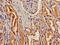 Gamma-Butyrobetaine Hydroxylase 1 antibody, LS-C673611, Lifespan Biosciences, Immunohistochemistry paraffin image 