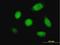 Dual Specificity Phosphatase 5 antibody, H00001847-M04, Novus Biologicals, Immunocytochemistry image 