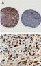 Caspase 8 antibody, NBP1-05123, Novus Biologicals, Immunohistochemistry paraffin image 