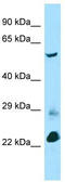 BTB Domain Containing 3 antibody, TA338072, Origene, Western Blot image 