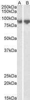 Solute Carrier Family 47 Member 2 antibody, 42-924, ProSci, Western Blot image 