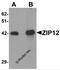 Solute Carrier Family 39 Member 12 antibody, 6101, ProSci, Western Blot image 