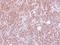 Ankyrin Repeat And KH Domain Containing 1 antibody, NBP2-15395, Novus Biologicals, Immunohistochemistry paraffin image 