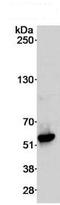 DEAD-Box Helicase 6 antibody, ab70455, Abcam, Immunoprecipitation image 