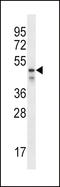 PDZ Domain Containing 1 antibody, LS-C163509, Lifespan Biosciences, Western Blot image 