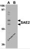 CtIP antibody, 5751, ProSci, Western Blot image 