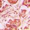 Calumenin antibody, LS-C668261, Lifespan Biosciences, Immunohistochemistry paraffin image 