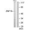 Zinc Finger Protein 18 antibody, A14630, Boster Biological Technology, Western Blot image 