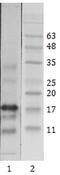 Lysine Acetyltransferase 5 antibody, MA1-71508, Invitrogen Antibodies, Western Blot image 
