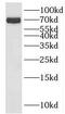 Kelch Like Family Member 34 antibody, FNab04626, FineTest, Western Blot image 