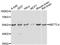 Methyltransferase Like 4 antibody, STJ111645, St John