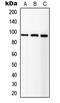 Insulin Like Growth Factor 1 Receptor antibody, LS-C352366, Lifespan Biosciences, Western Blot image 