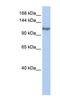 Trimethylguanosine Synthase 1 antibody, NBP1-54942, Novus Biologicals, Western Blot image 