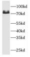 Fermitin Family Member 3 antibody, FNab03078, FineTest, Western Blot image 