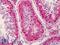Nanos C2HC-Type Zinc Finger 3 antibody, LS-B4983, Lifespan Biosciences, Immunohistochemistry paraffin image 