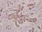 Serine/threonine-protein kinase PRKY antibody, PA5-36511, Invitrogen Antibodies, Immunohistochemistry frozen image 