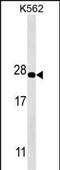 Proteasome Subunit Alpha 5 antibody, M07499, Boster Biological Technology, Western Blot image 