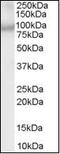 ArfGAP With Coiled-Coil, Ankyrin Repeat And PH Domains 2 antibody, orb88098, Biorbyt, Western Blot image 
