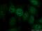Kinesin Family Member 2C antibody, 12139-1-AP, Proteintech Group, Immunofluorescence image 