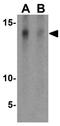 Serine Peptidase Inhibitor, Kazal Type 7 (Putative) antibody, GTX31458, GeneTex, Western Blot image 