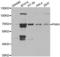 P21 (RAC1) Activated Kinase 4 antibody, abx002088, Abbexa, Western Blot image 