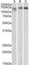 Fibrinogen Like 1 antibody, 42-206, ProSci, Enzyme Linked Immunosorbent Assay image 