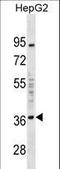 Ectodysplasin A2 Receptor antibody, LS-C159507, Lifespan Biosciences, Western Blot image 