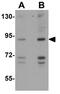 Glycerol-3-Phosphate Acyltransferase, Mitochondrial antibody, GTX85034, GeneTex, Western Blot image 