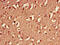 Tyrosine 3-Monooxygenase/Tryptophan 5-Monooxygenase Activation Protein Eta antibody, LS-C317030, Lifespan Biosciences, Immunohistochemistry paraffin image 