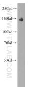 Brevican antibody, 19017-1-AP, Proteintech Group, Western Blot image 