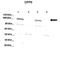 Dipeptidyl Peptidase Like 6 antibody, NBP1-59427, Novus Biologicals, Western Blot image 