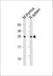 Suppressor Of Cytokine Signaling 1 antibody, MBS9210758, MyBioSource, Western Blot image 