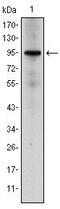 Nuclear Receptor Subfamily 3 Group C Member 1 antibody, MA5-15801, Invitrogen Antibodies, Western Blot image 