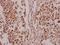Protein Kinase C Delta antibody, A00822S645, Boster Biological Technology, Immunohistochemistry frozen image 