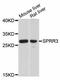 Small Proline Rich Protein 3 antibody, A12041, ABclonal Technology, Western Blot image 