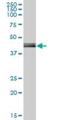 Phosphate Cytidylyltransferase 2, Ethanolamine antibody, H00005833-B01P, Novus Biologicals, Western Blot image 